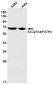 SLC27A4 / FATP4 Rabbit mAb ABZ2025