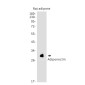 Adiponectin Rabbit mAb ABZ2032
