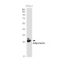 Adiponectin Rabbit mAb ABZ2032