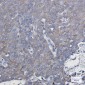 NDUFAF5 Rabbit mAb ABZ2036