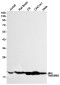 Transmembrane Protein 85 Rabbit mAb ABZ2041