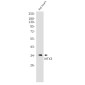 MTX3 Rabbit mAb ABZ2043
