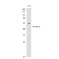 TXNRD1 Rabbit mAb ABZ2051
