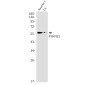 PFKFB3 Rabbit mAb ABZ2052