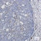 CYP1B1 Rabbit mAb ABZ2057