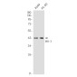 MAPKAPK3 Rabbit mAb ABZ2061