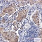 SMN/Gemin 1 Rabbit mAb ABZ2062