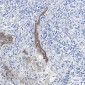 Extracellular Matrix Protein 1 Rabbit mAb ABZ2066