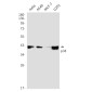 p38 MAPK Rabbit mAb ABZ2072