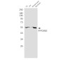 PPP2R5E Rabbit mAb ABZ2073