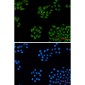 DDB1 Rabbit mAb ABZ2075