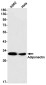 Adiponectin Rabbit mAb ABZ2081
