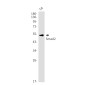 Smad2 Rabbit mAb ABZ2083