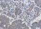 IKB beta Rabbit mAb ABZ2089