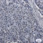 SAFB1 Rabbit mAb ABZ2092