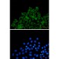 TOMM20 Rabbit mAb ABZ2096