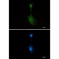 RSK3 Rabbit mAb ABZ2098