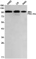PKC mu/PKD Rabbit mAb ABZ2105