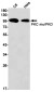 PKC mu/PKD Rabbit mAb ABZ2106