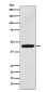 PDK1 Rabbit mAb ABZ2108