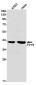 P2Y6 Rabbit mAb ABZ2111