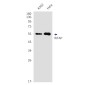 WTAP Rabbit mAb ABZ2116