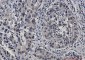 STAT4 Rabbit mAb ABZ2118
