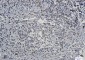 Lamin B Receptor Rabbit mAb ABZ2120