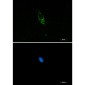 Pumilio 1 Rabbit mAb ABZ2125