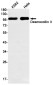 Desmocollin 3 Rabbit mAb ABZ2129