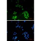 ENT2 Rabbit mAb ABZ2131
