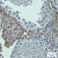 Metabotropic Glutamate Receptor 2 Rabbit mAb ABZ2133