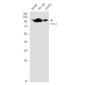 PTK2B Rabbit mAb ABZ2136