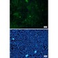 Cortactin Rabbit mAb ABZ2138