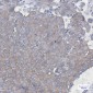 Cortactin Rabbit mAb ABZ2138