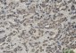 Keap1 Rabbit mAb ABZ2139