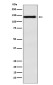 Integrin alpha 9 Rabbit mAb ABZ2145