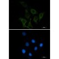 CD166 Rabbit mAb ABZ2147