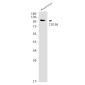 CD166 Rabbit mAb ABZ2147