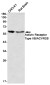 Activin Receptor Type IIB Rabbit mAb ABZ2148