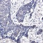 FHL1 Rabbit mAb ABZ2150