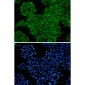 SNX1 Rabbit mAb ABZ2158