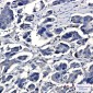 IQGAP2 Rabbit mAb ABZ2160