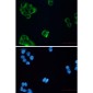 beta III Tubulin Rabbit mAb ABZ2168