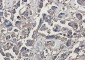 beta III Tubulin Rabbit mAb ABZ2168