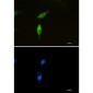 SQSTM1/p62 Rabbit mAb ABZ2170