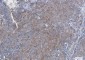 SQSTM1/p62 Rabbit mAb ABZ2170