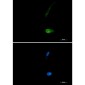 SQSTM1/p62 Rabbit mAb ABZ2171