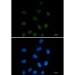 CTBP1 Rabbit mAb ABZ2179