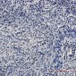CTBP1 Rabbit mAb ABZ2179